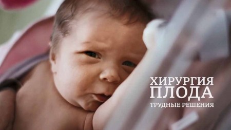 Детские хирурги: совершая чудеса 1 серия / Baby Surgeons: Delivering Miracles (2021)